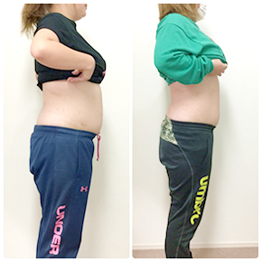 ビフォーアフターの写真1