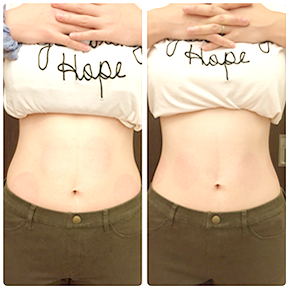 ビフォーアフターの写真2